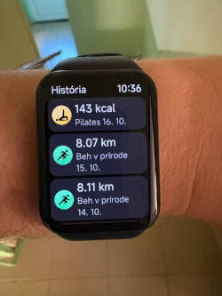 Históriu tréningov si viete prezerať priamo na náramku
