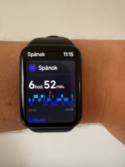 Jednotlivé spánkové fázy vidíte priamo na náramku