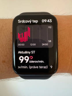 Grafické znázornenie srdcového tepu